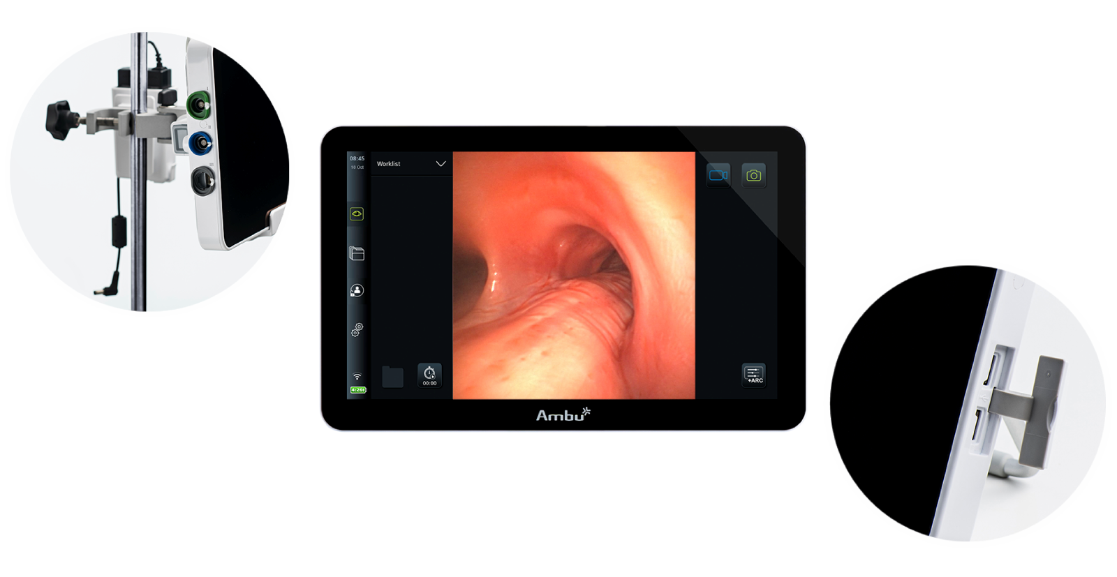 Monitor aView Advance